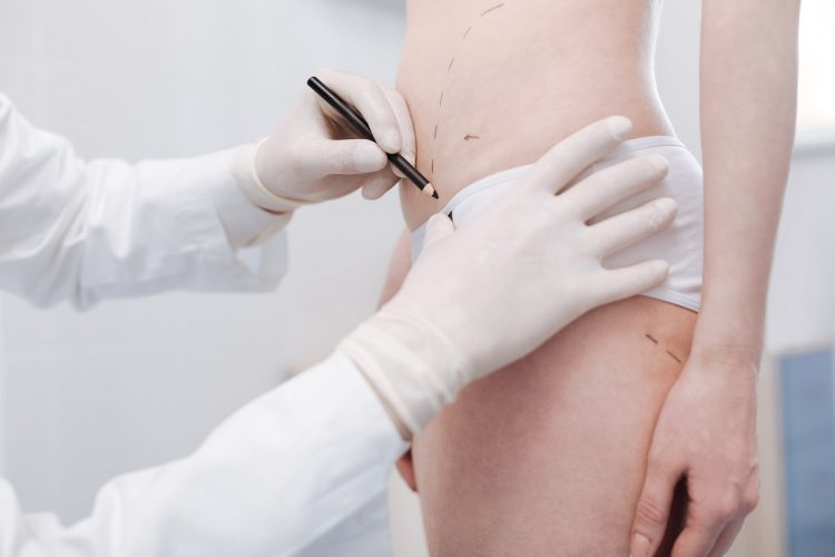 Delicate excellent specialist marking the guidelines for surgery