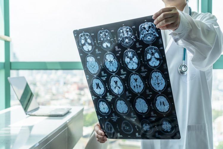 Brain disease diagnosis with medical doctor seeing Magnetic Reso